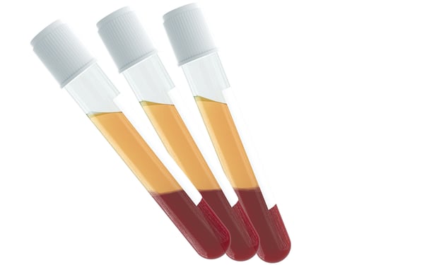 ResearchDonors_Img_Plasma