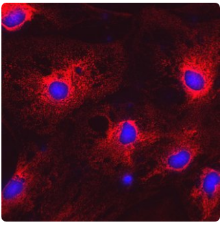 Endoplasmic-Reticulum