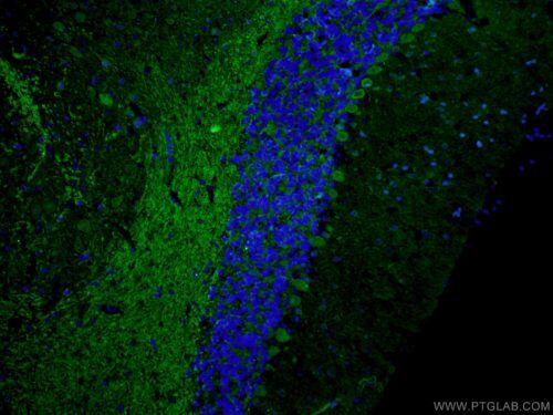 DCX Antibody