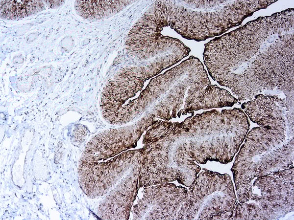 New Antibodies Released from DBS