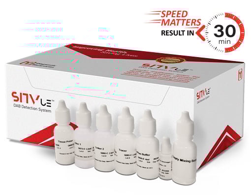 NEW: SITVue/DAB Detection System