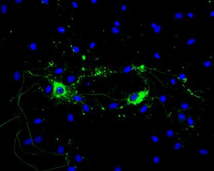 Rat primary hippocampal neurons treated with mouse Type 1 alpha synuclein PFFs show Lewy body inclusions