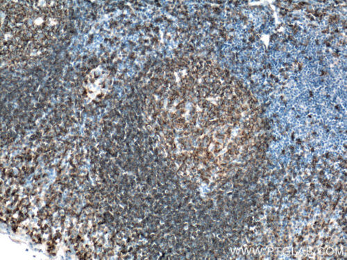 Leukemia CD19 Antibody