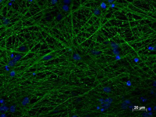 TUBB3 Antibody