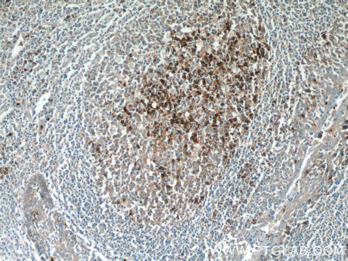 Leukemia CD38 Antibody