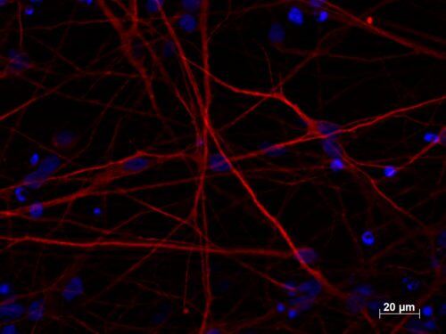 MAP2B Antibody