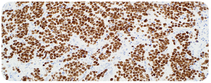 Pediatric Pathology