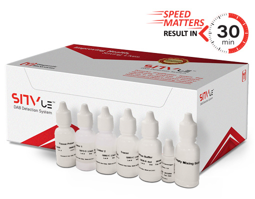 NEW: SITVue/DAB Detection System