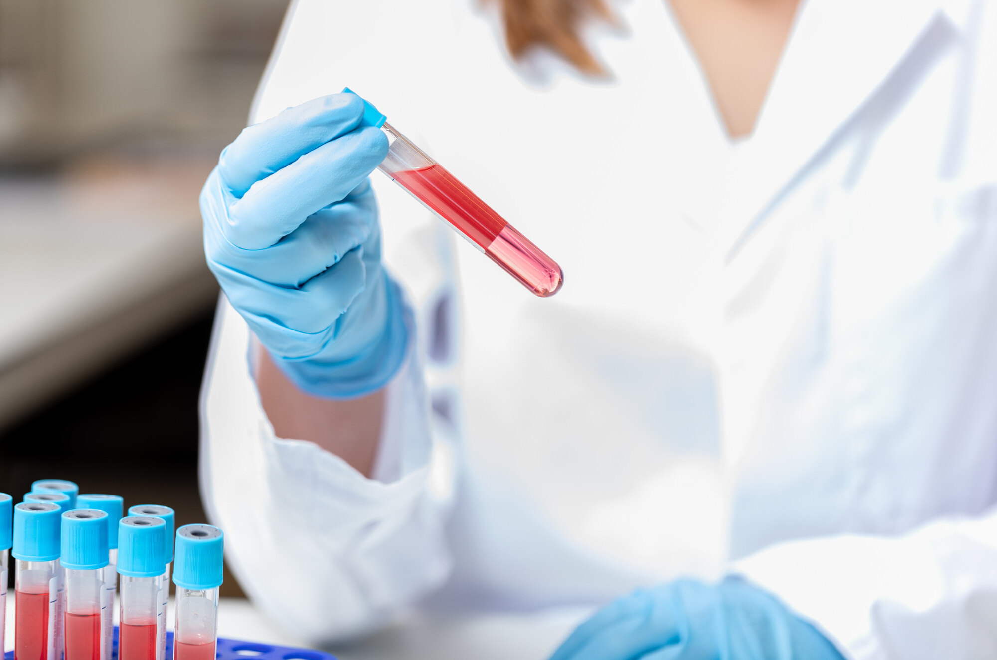 What is Flow Cytometry?