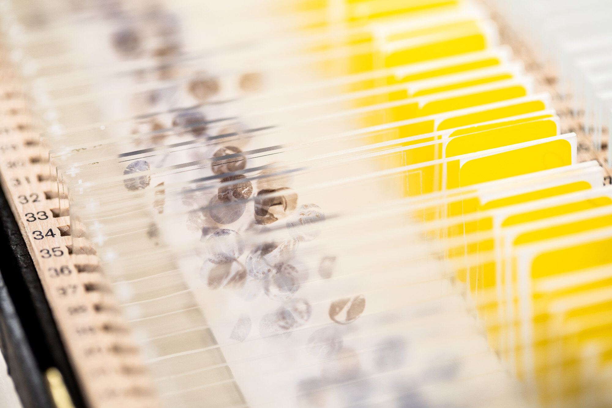 Breast Cancer & Immunohistochemistry