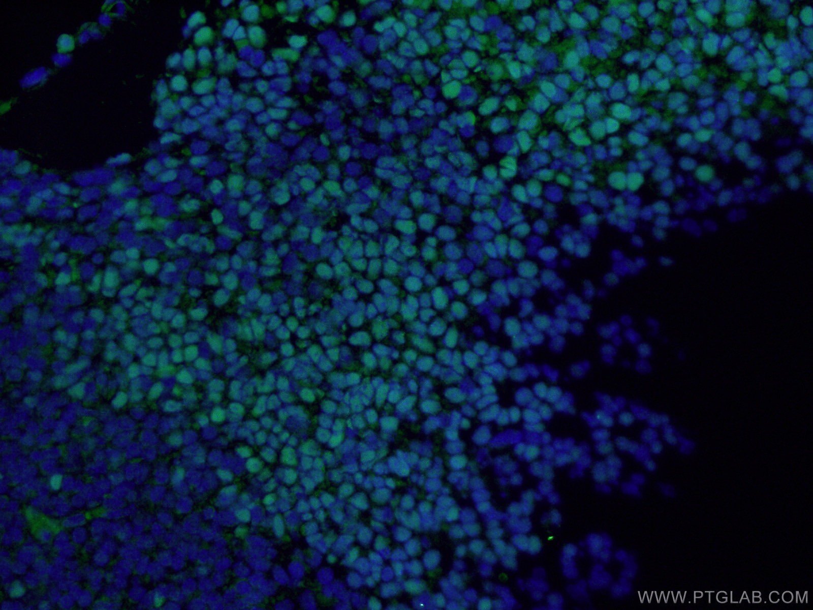 Markers of neuronal precursor cells (NPCs) / neural stem cells (NSCs)