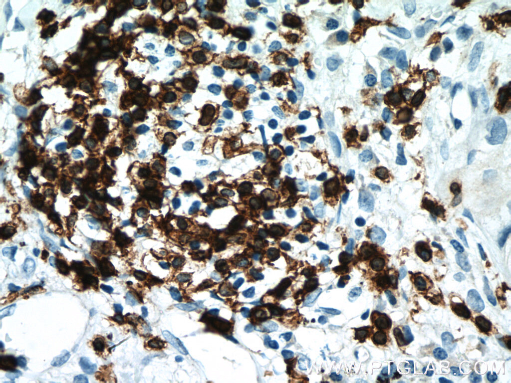 Antibodies in leukemia research and diagnosis